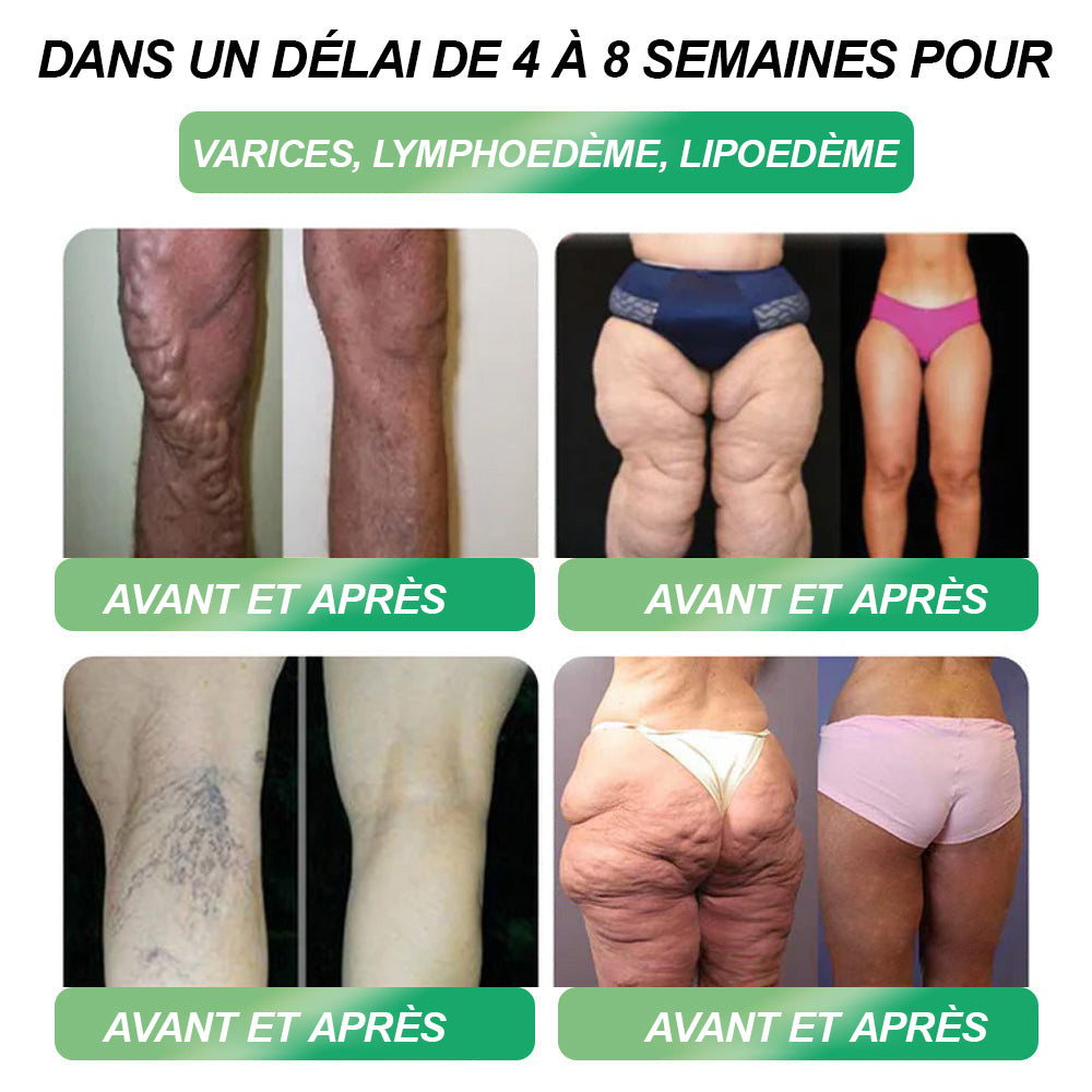 Magasin officiel | 𝑯𝑯𝑽𝑩®🎁𝑮𝑳𝑷-1 SIX EN-UN Solution de santé orale (Juste une dose par jour, changements visibles en 7 jours) ✅ Pour l'obésité, la santé cardiovasculaire, le diabète, l'apnée du sommeil, les problèmes articulaires et plus encore.